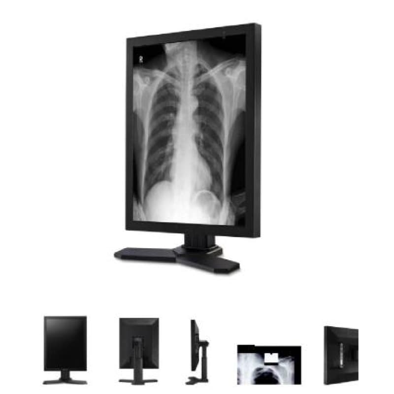  显辉G3213 21.3 寸 3MP 灰阶显示器