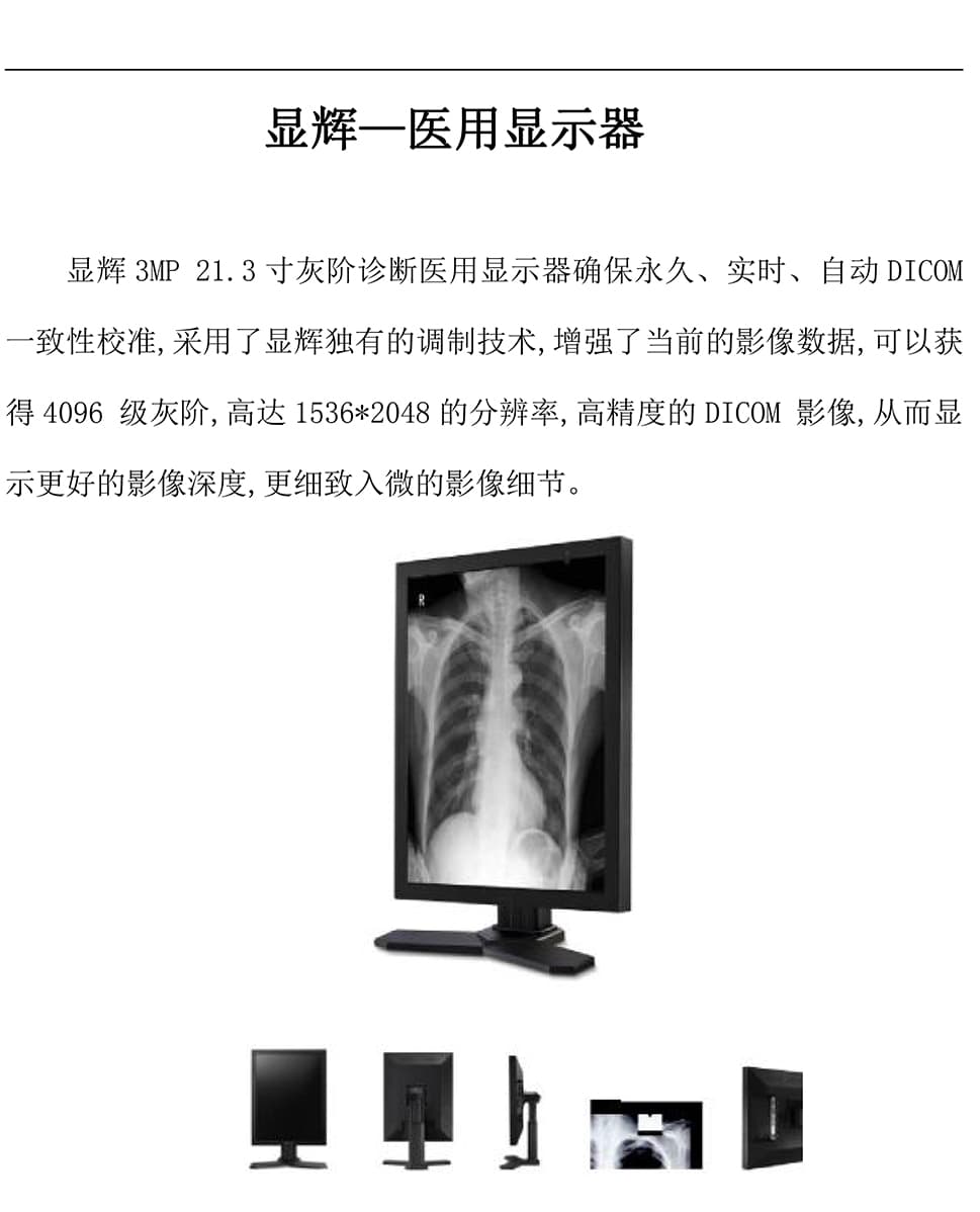  显辉G3213 21.3 寸 3MP 灰阶显示器 1