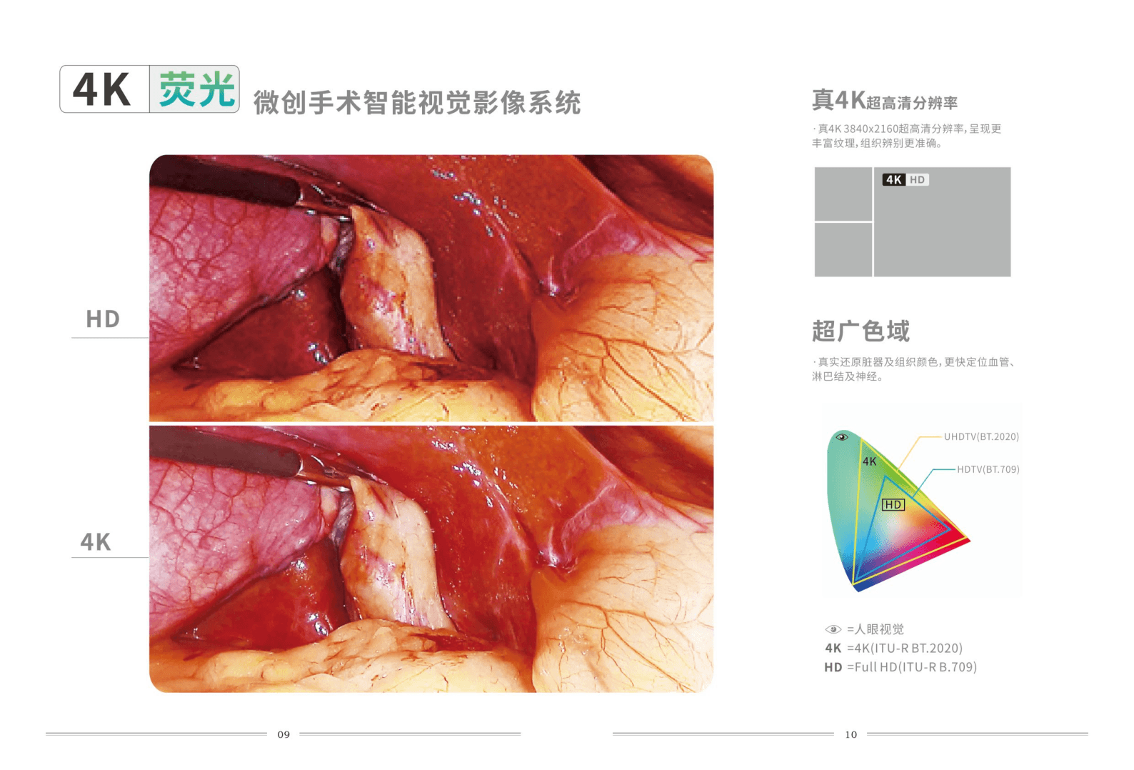 4cmos 4K+IR（荧光）微创手术智能视觉影像系统 3