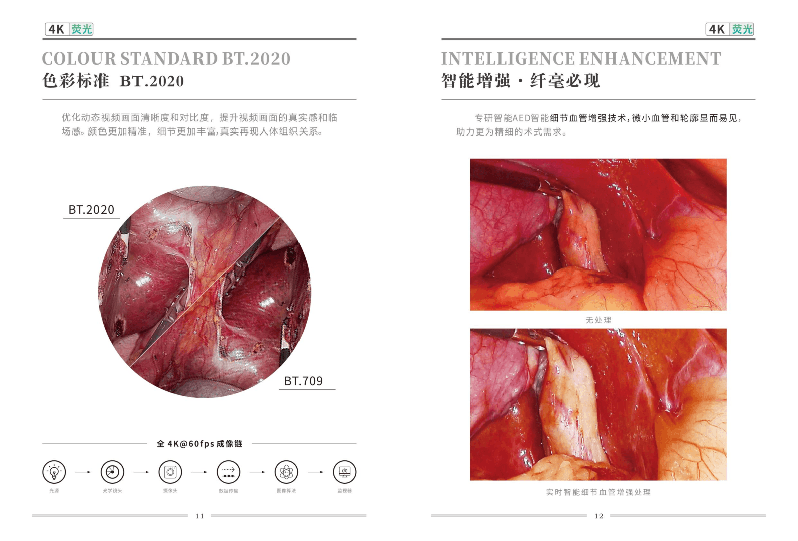 4cmos 4K+IR（荧光）微创手术智能视觉影像系统 4
