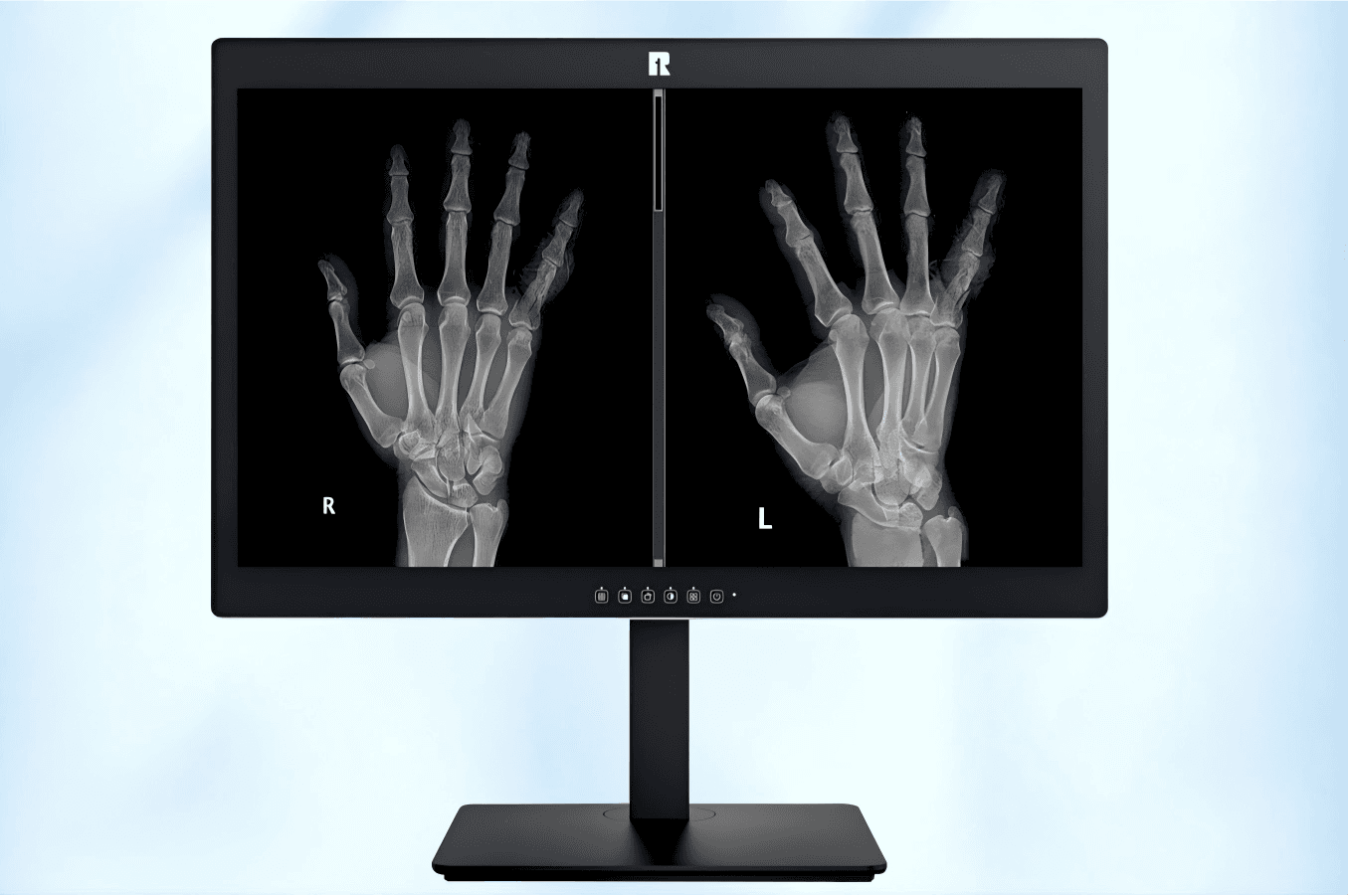 RUING Medical Monitor KL-200M