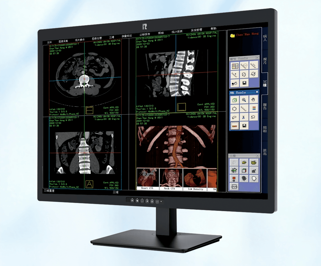 RUING Medical Monitor KL-400M
