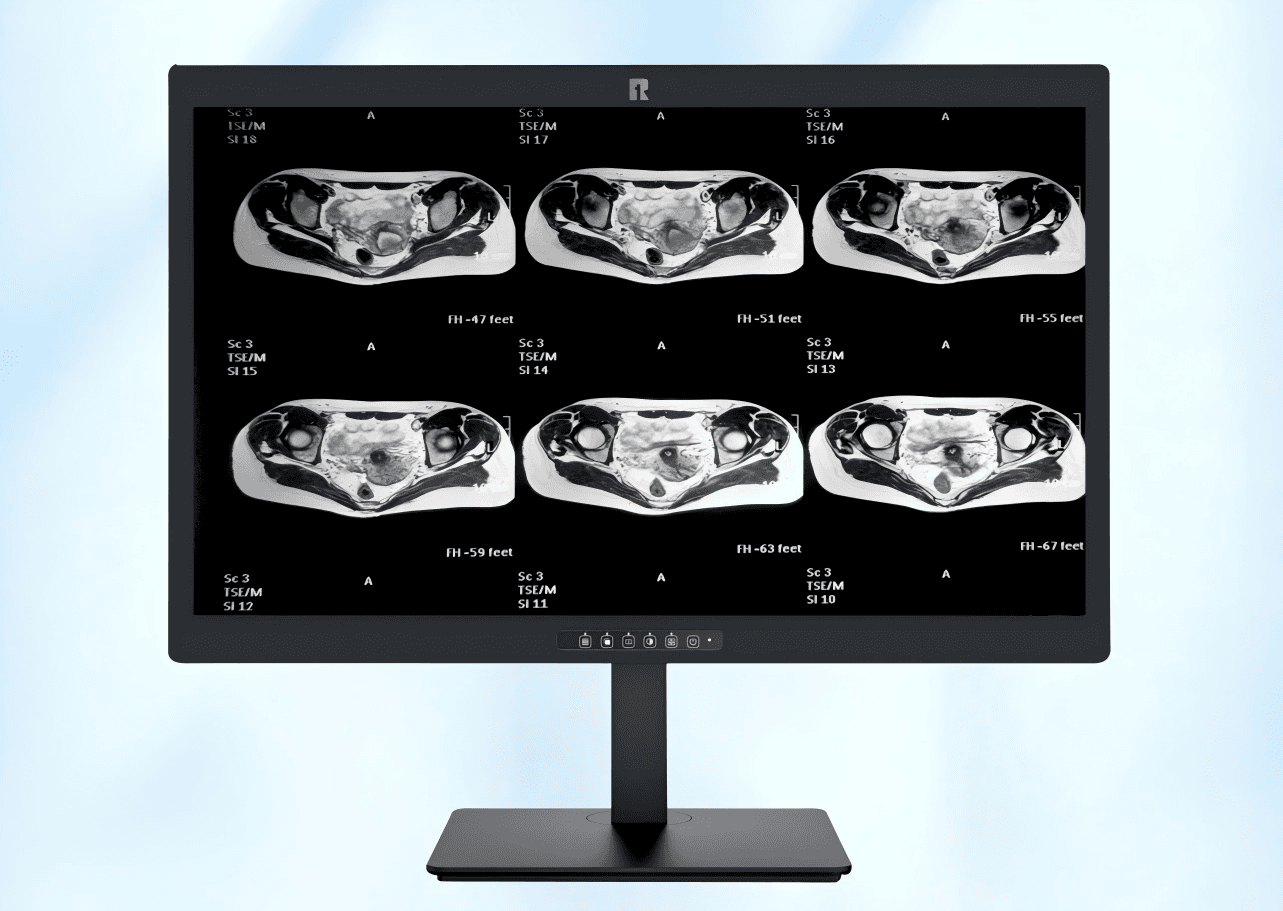 RUING Medical Monitor KL-400S