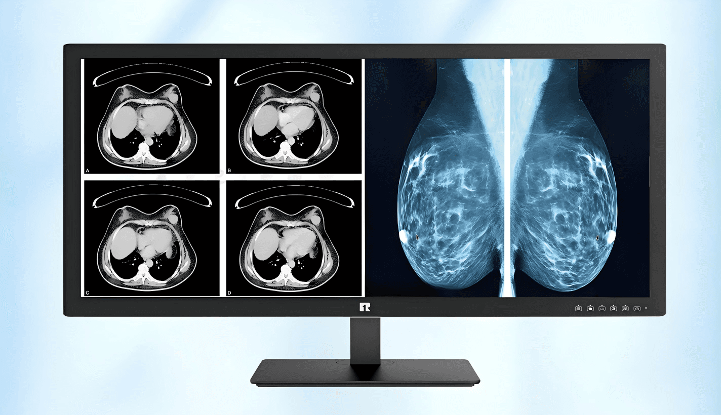 RUING Medical Monitor KL-500S