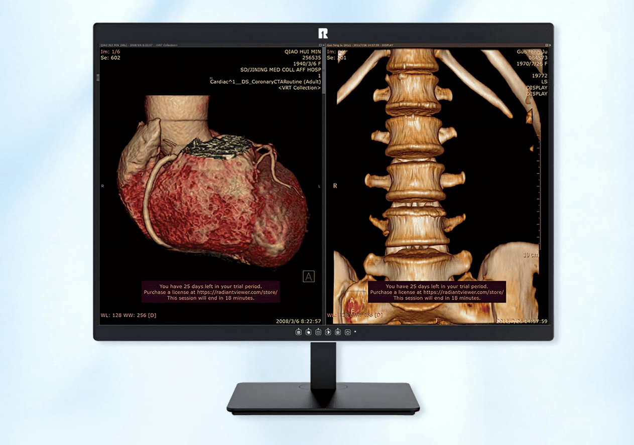 RUING Medical Monitor KL-600M