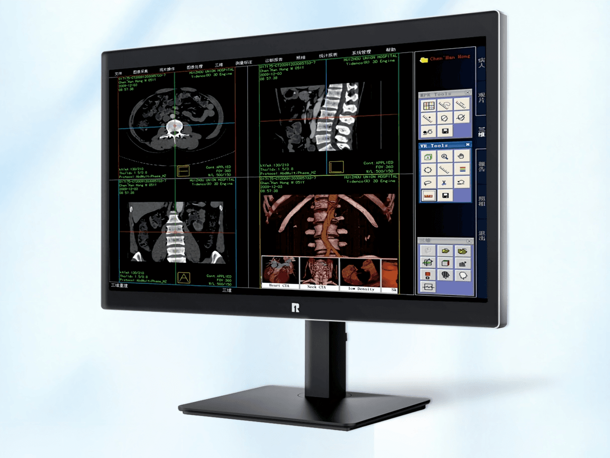 RUING Medical Monitor KL-800S